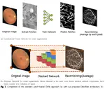 Retinal Vessel Detection Using Deep Learning: A novel DirectNet Architecture